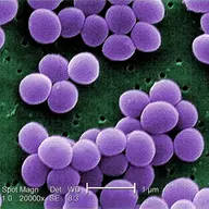 Staphylococcus aureus