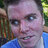 Gregscircumcisionscar