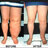 Lymphedema